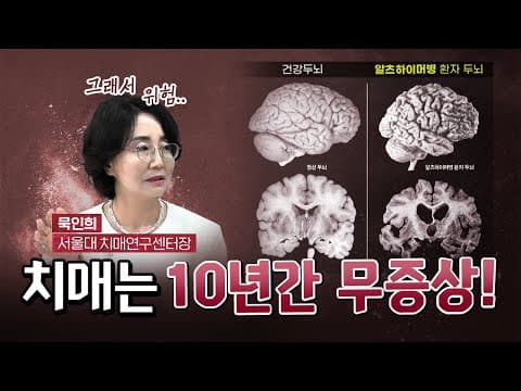 치매 세계 최고 권위자 “치매, 발견하면 치료제 있다.” [코너별 다시보기 - 0831]
